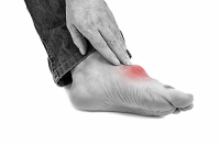 What Does Uric Acid Have to Do with Gout?