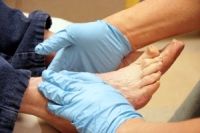 Effects of Diabetes on the Feet