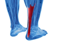 Possible Causes Of An Achilles Tendon Injury