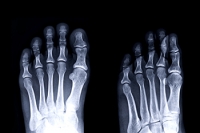 What Is the Forefoot?