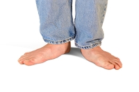 Causes of Acquired Flat Feet
