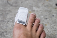 Broken Toes and Maintaining Cardiovascular Health