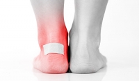 Foot Blisters May Be Common Among Soccer Players